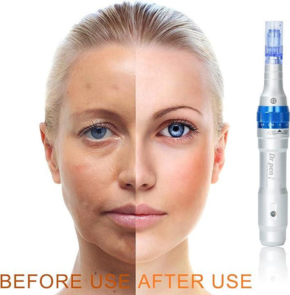 Dr. Pen  A6 before after